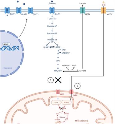 Ketogenic therapies for glioblastoma: Understanding the limitations in transitioning from mice to patients